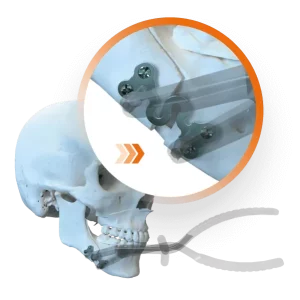 Imagens Placa S Site Imagens Placa S Site